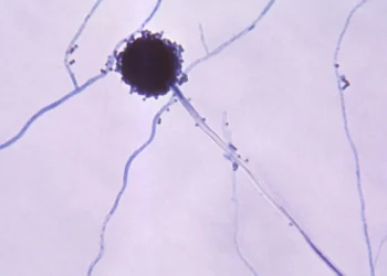 تحذير من انتشارها السريع.. فطريات قاتلة تأكل لحمك من الداخل