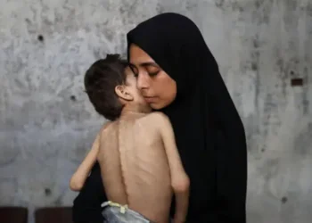 "الوضع يائس".. بريطانيا تدعو إسرائيل لإنهاء المجاعة في غزة